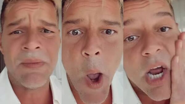 Ricky Martin aclara rumores de inyecciones de botox en su rostro