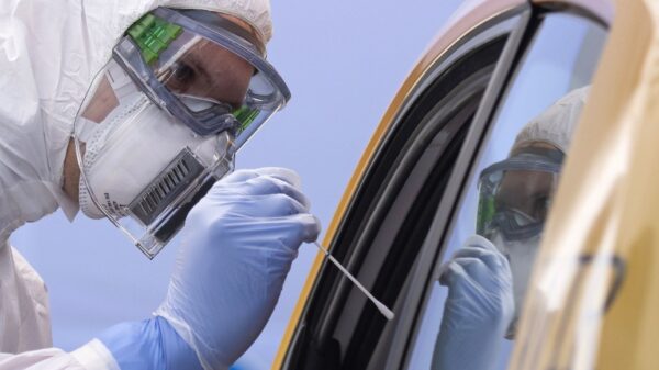 Sobrevivientes de Covid-19 podrían padecer “síndrome del ano inquieto”