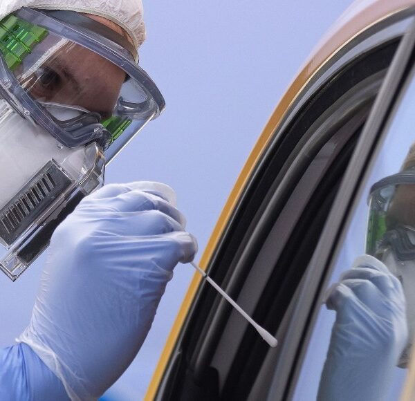 Sobrevivientes de Covid-19 podrían padecer “síndrome del ano inquieto”