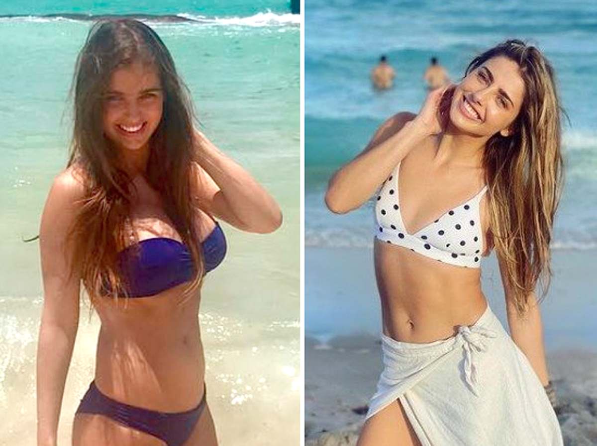 Michelle Renaud “ama ser plana” tras quitarse implantes mamarios