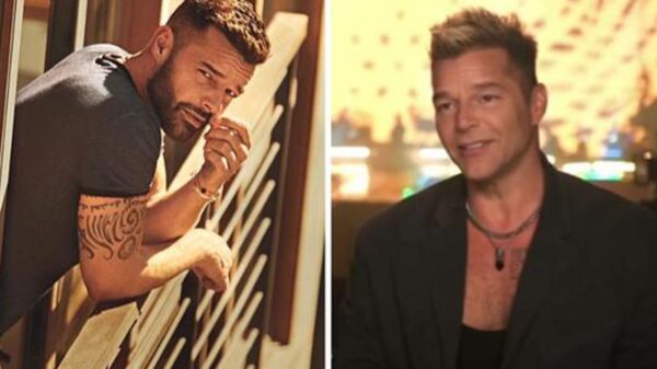 La verdad sobre los cambios en la cara de Ricky Martin
