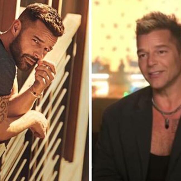 La verdad sobre los cambios en la cara de Ricky Martin