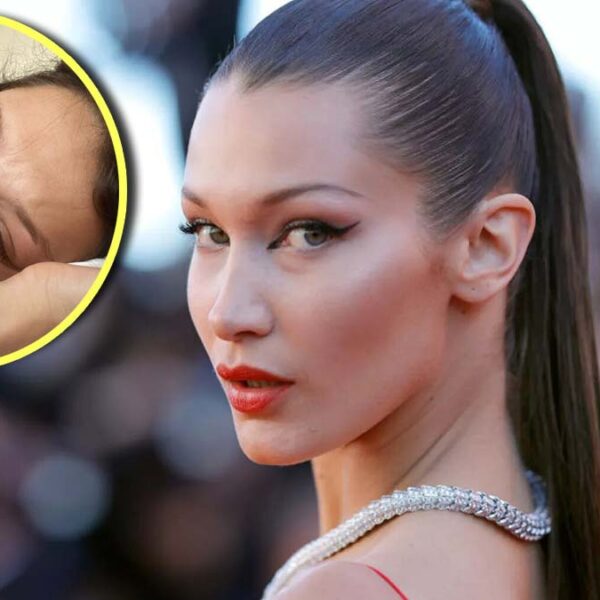 Bella Hadid muestra su lucha constante con la ansiedad y depresión
