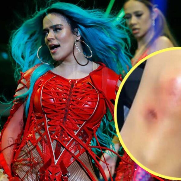 Estas fueron las lesiones que tuvo Karol G por su caída en pleno concierto