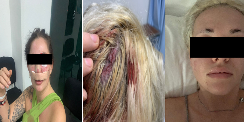 Playa del Carmen: Detienen por intento de feminicidio a peleador canadiense; fueron dos las víctimas de Peter “N” en un bar.