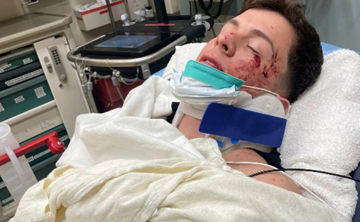 Guaynaa sufre fuerte accidente en Los Ángeles