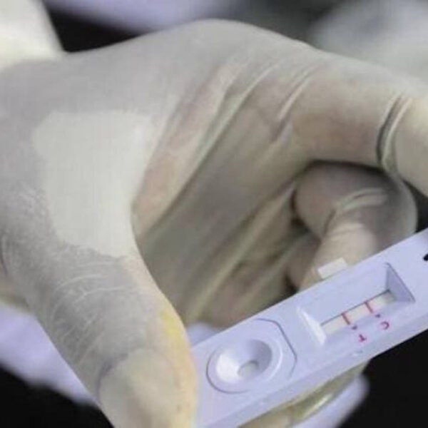 Profeco alerta sobre la venta de pruebas Covid chinas: no son confiables