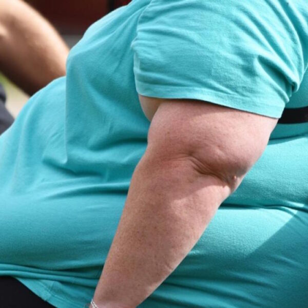 Según estudios la obesidad podría ser hereditaria