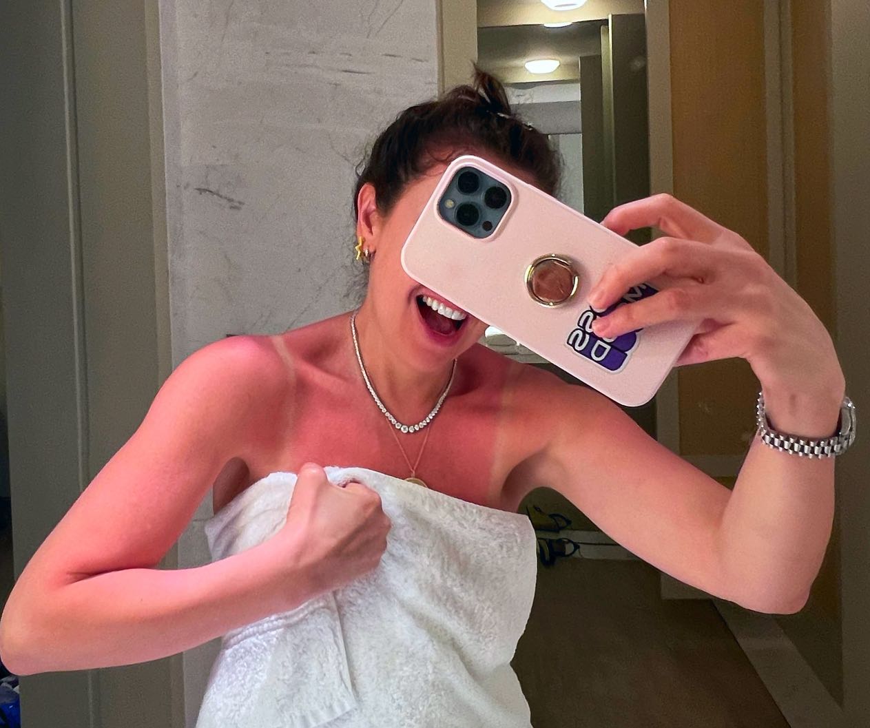 Thalía presume sus dolorosas quemaduras tras broncearse