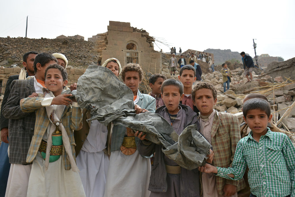 Los niños se llevan la peor parte de los enfrentamientos de los adultos en Yemen.