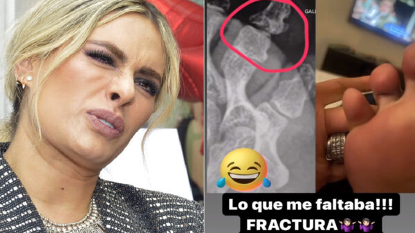 Galilea Montijo sufre fractura en pleno programa “Hoy”