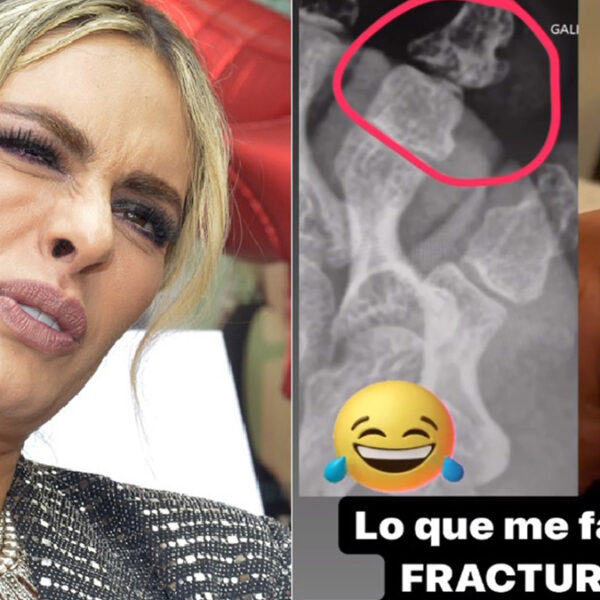 Galilea Montijo sufre fractura en pleno programa “Hoy”