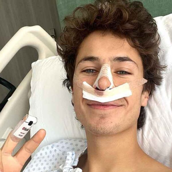 Por esta enfermedad Juanpa Zurita se operó la nariz