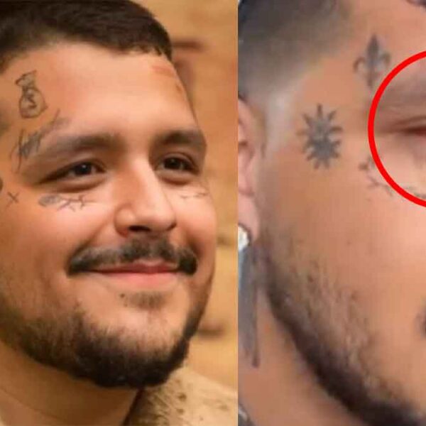 ¿Lo golpearon? Christian Nodal preocupa a sus seguidores por lesión en el ojo