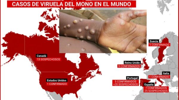 Se acerca Viruela del Mono a México, detectan casos en EEUU y Canadá