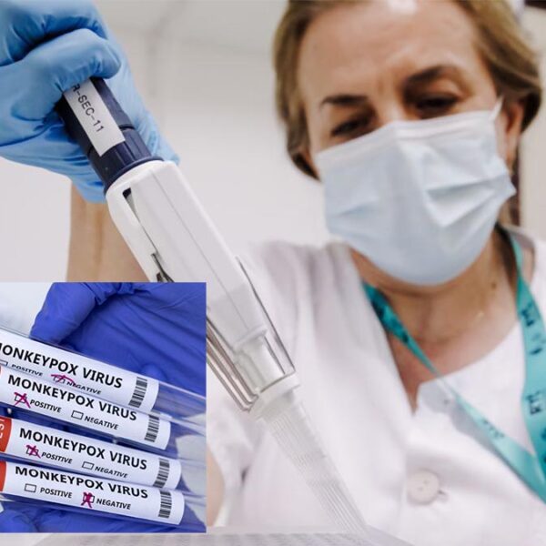 Descarta OMS que viruela del mono se convierta en pandemia