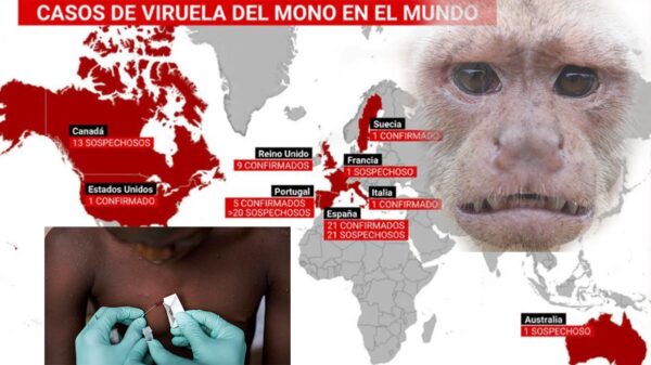 Se expande Viruela del mono, ya hay casos en 11 países