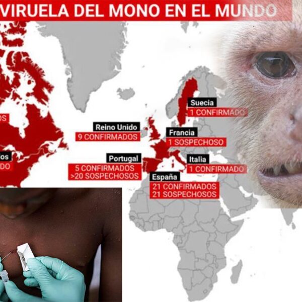Se expande Viruela del mono, ya hay casos en 11 países