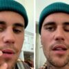 Justin Bieber cancela conciertos por parálisis facial