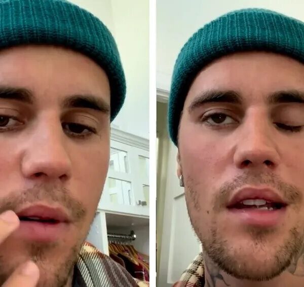 Justin Bieber cancela conciertos por parálisis facial