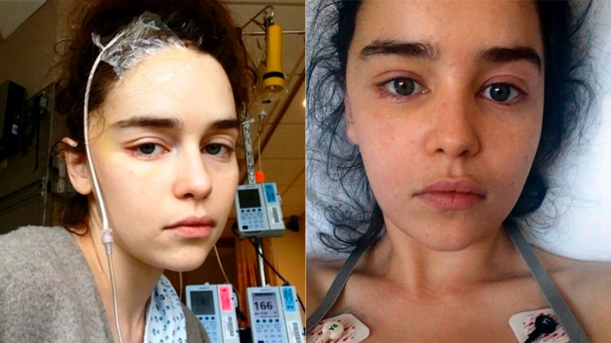 Emilia Clarke revela que partes de su cerebro ya no funcionan