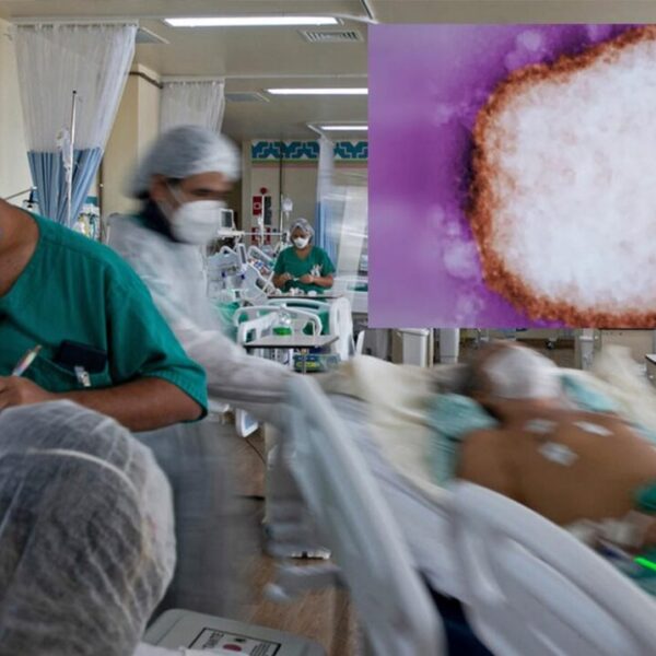 Viruela del Mono empieza a cobrar sus primeras muertes