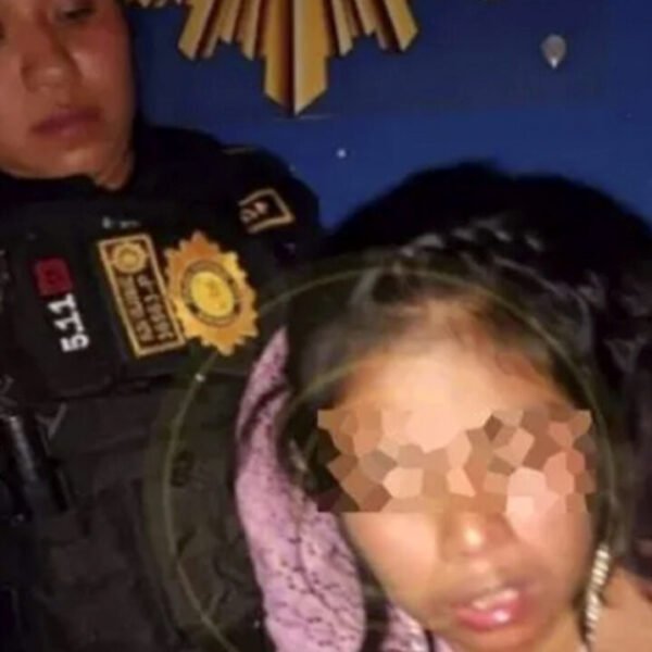Mujer da mordida a policía...y le corta el dedo
