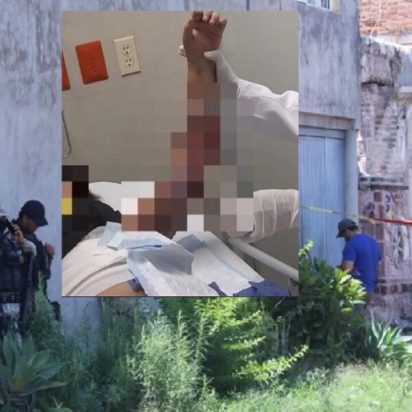 Niña es torturada quemándola en albergue clandestino de Jalisco