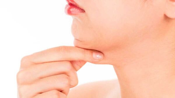 El truco clave para eliminar la papada sin necesidad de cirugía