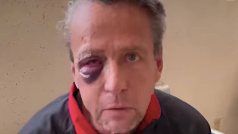 Alfredo Adame revela tener video del momento que lo golpean con una piedra