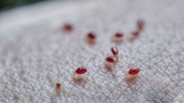 Checa estos trucos para eliminar la plaga de chinches