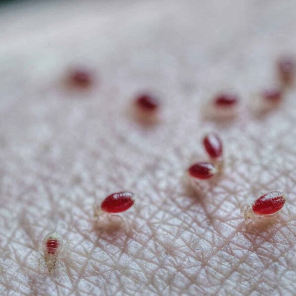 Checa estos trucos para eliminar la plaga de chinches