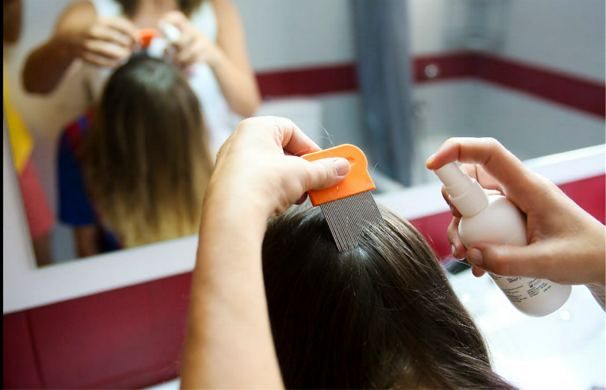 Elimina los piojos con estos tips