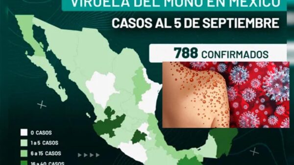 Viruela del Mono aumenta a 788 casos en México