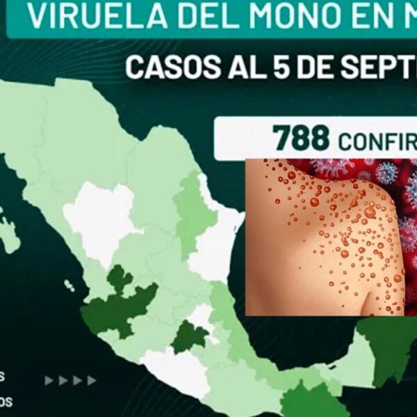 Viruela del Mono aumenta a 788 casos en México