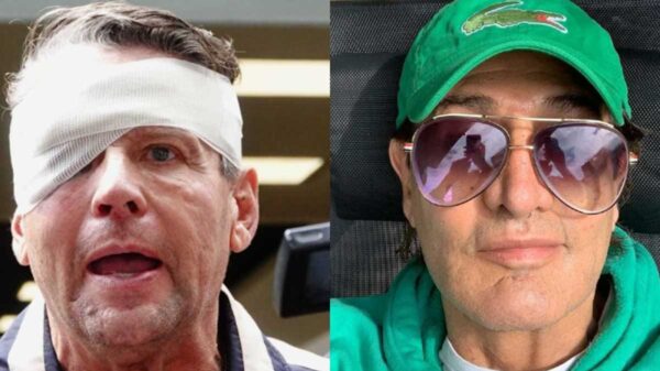 Alfredo Adame compara su rostro con el de 'Fabiruchis' tras golpiza