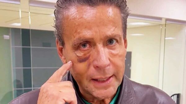 Alfredo Adame es sometido a cirugía por lesiones en su ojo