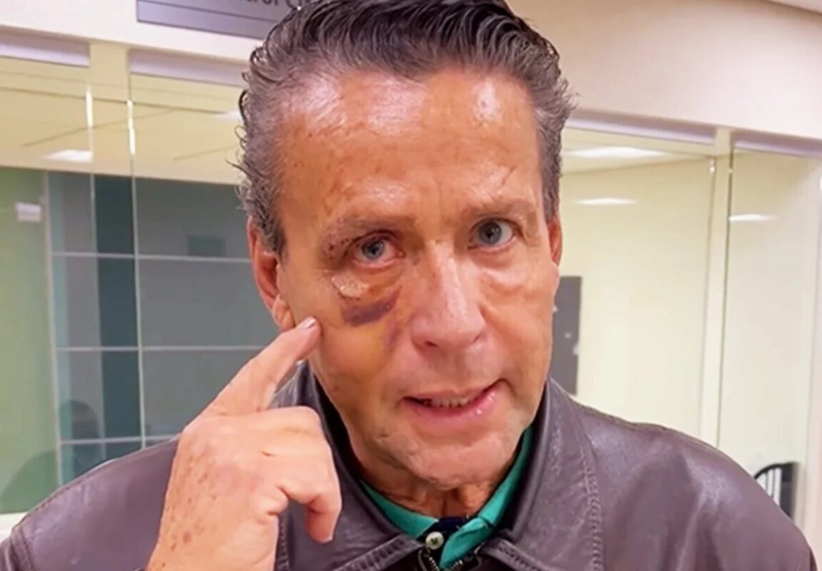 Alfredo Adame fue dado de alta tras cirugía en el ojo