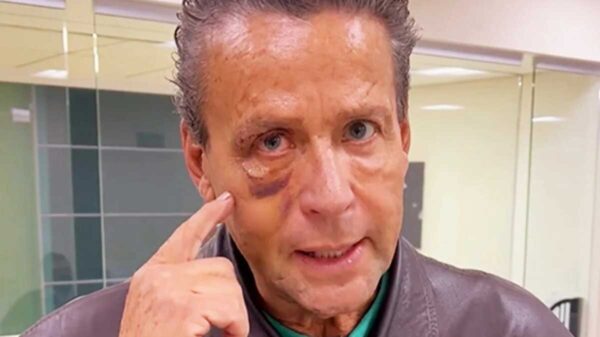 Alfredo Adame revela el motivo por el que se operó en un hospital público