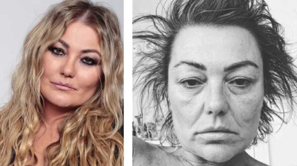 Amaia Montero, ex vocalista de 'La Oreja de Van Gogh', alerta a fans por su físico en foto