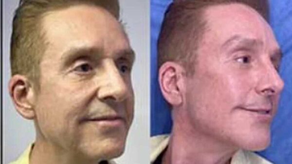 Daniel Bisogno se somete a rejuvenecimiento facial