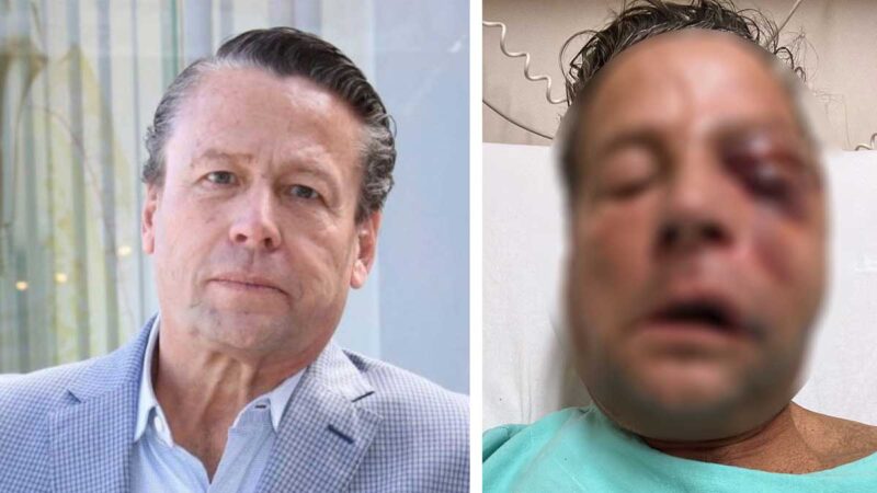 Así quedó el rostro de Alfredo Adame tras ser sometido quirúrgicamente por golpiza