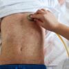 Sarampión amenaza con regresar, hay varios brotes: OMS