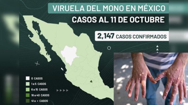 Rebasa México los dos mil casos de Viruela del mono