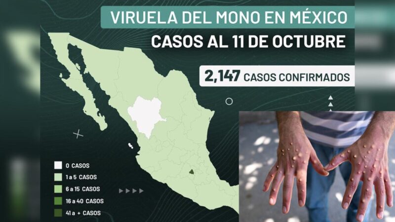 Rebasa México los dos mil casos de Viruela del mono