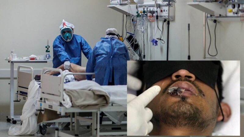 Crece en México numero de muertes por Viruela del Mono 