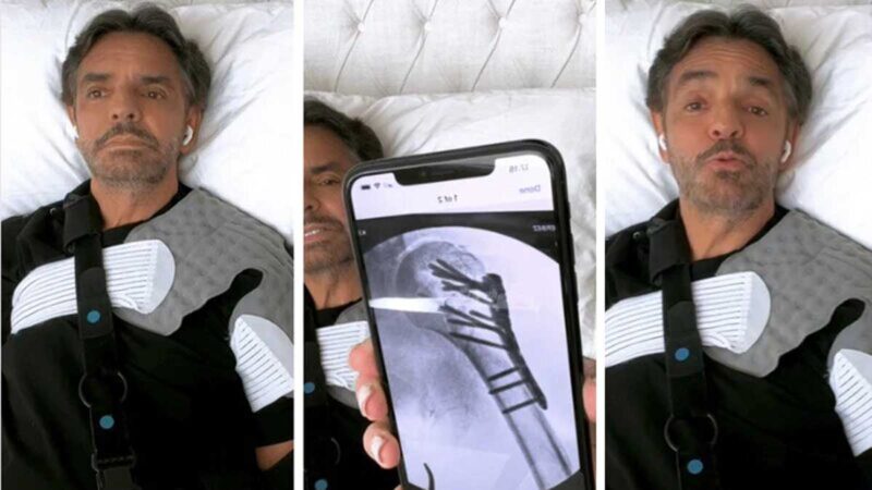 Esta lección aprendió Eugenio Derbez tras su accidente