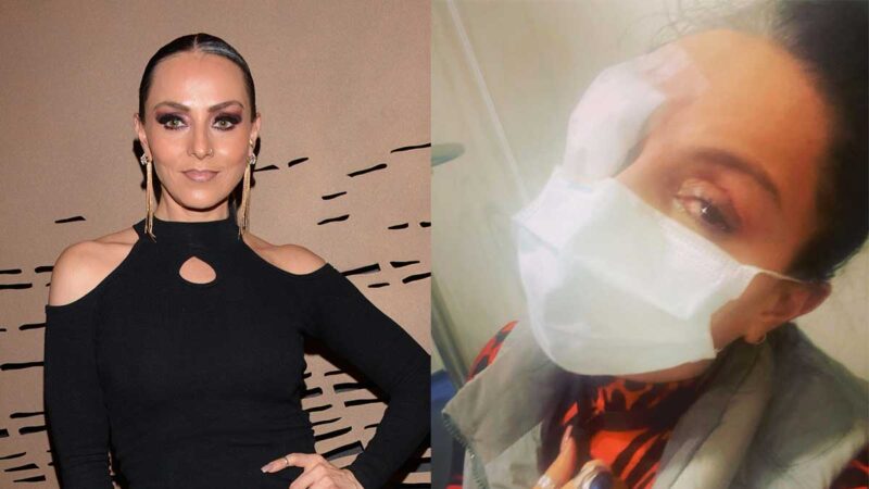 Ivonne Montero sufre fatal accidente en el ojo derecho