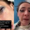 ¿La internaron a un psiquiátrico? Cuñada de Yuya pide auxilio y por haber sido golpeada