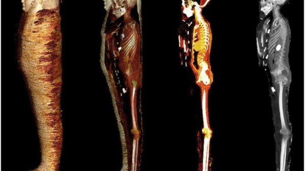 Desenvuelven digitalmente a un ‘chico de oro’ de más de 2 mil años